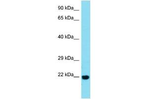 Host:  Rabbit  Target Name:  BTBD2  Sample Type:  Esophagus Tumor lysates  Antibody Dilution:  1. (BTBD2 antibody  (C-Term))