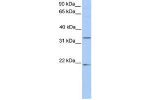 WB Suggested Anti-FUT6 Antibody Titration:  0. (FUT6 antibody  (C-Term))