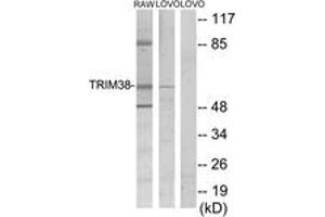 Western blot analysis of extracts from LOVO/RAW264. (TRIM38 antibody  (AA 161-210))