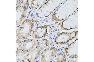 Immunohistochemistry of paraffin-embedded human stomach using MAPK1 antibody. (ERK2 antibody  (N-Term))
