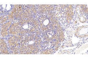 Immunohistochemistry (IHC) image for anti-Cytochrome C Oxidase Subunit II (COX2) (AA 83-227) antibody (ABIN7445771)