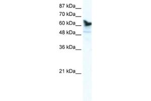 Western Blotting (WB) image for anti-DEAD (Asp-Glu-Ala-Asp) Box Polypeptide 41 (DDX41) antibody (ABIN2461350) (DDX41 antibody)