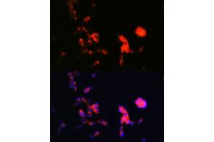 Immunofluorescence analysis of SH-SY5Y cells using DKK3 Rabbit mAb (ABIN1680063, ABIN3018243, ABIN3018244 and ABIN7101586) at dilution of 1:100 (40x lens). (DKK3 antibody)
