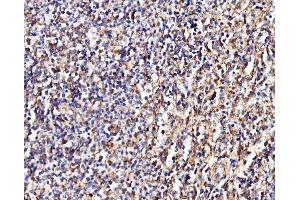 IHC analysis of MPPB/PMPCB using anti-MPPB/PMPCB antibody (ABIN7600758).