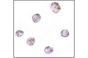 Immunocytochemistry of RGS21 in HepG2 cells with this product at 2. (RGS21 antibody  (Center))