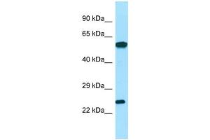 WB Suggested Anti-DGUOK Antibody Titration: 1. (Deoxyguanosine Kinase antibody  (C-Term))