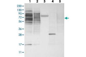 Western blot analysis of Lane 1: RT-4, Lane 2: U-251 MG, Lane 3: Human Plasma, Lane 4: Liver, Lane 5: Tonsil with ZSCAN2 polyclonal antibody . (ZSCAN2 antibody)