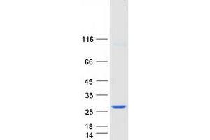 Validation with Western Blot