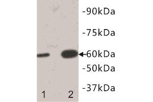 Western Blotting (WB) image for anti-Interleukin 13 Receptor, alpha 1 (IL13RA1) antibody (ABIN1854925) (IL13 Receptor alpha 1 antibody)