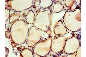 Immunohistochemistry of paraffin-embedded human thyroid tissue using ABIN7161554 at dilution of 1:100 (NAB2 antibody  (AA 1-200))