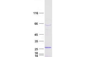Validation with Western Blot (SSX3 Protein (Transcript Variant 2) (Myc-DYKDDDDK Tag))