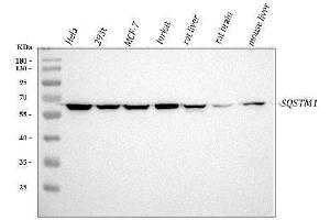 Western blot analysis of SQSTM1 using anti-SQSTM1 antibody (ABIN3043937). (SQSTM1 antibody  (N-Term))