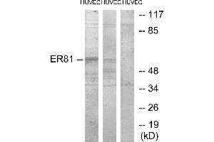 Western blot analysis of extracts from HUVEC cells treated with PMA (125ng/ml, 30mins), and HUVEC cells treated with serum (20%, 30mins), using ER81 antibody. (ETV1 antibody)