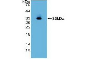 Detection of Recombinant ITGa2, Human using Polyclonal Antibody to Integrin Alpha 2 (ITGa2)