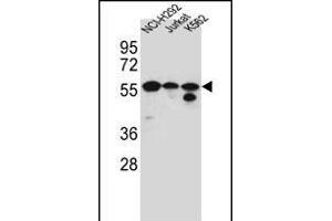 FOXN2 Antibody (N-term) (ABIN656184 and ABIN2845513) western blot analysis in NCI-,Jurkat,K562 cell line lysates (35 μg/lane). (FOXN2 antibody  (N-Term))