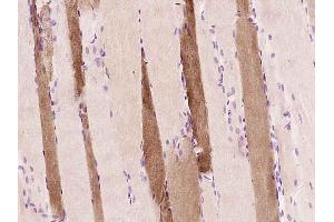 Paraformaldehyde-fixed, paraffin embedded Rat skeletal muscle Antigen retrieval by boiling in sodium citrate buffer (pH6. (Myoglobin antibody  (AA 2-154))