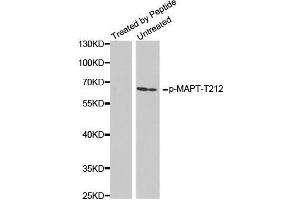 Western Blotting (WB) image for anti-Microtubule-Associated Protein tau (MAPT) (pThr212) antibody (ABIN3020349) (MAPT antibody  (pThr212))