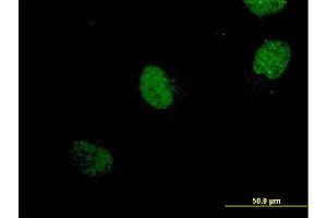 Immunofluorescence of monoclonal antibody to NEUROG1 on HeLa cell. (Neurogenin 1 antibody  (AA 82-163))
