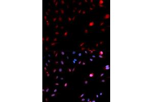 Immunofluorescence analysis of MCF-7 cells using Phospho-CDK1-Y15 antibody (ABIN5969877). (CDK1 antibody  (pTyr15))
