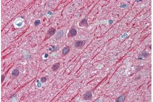 Human Brain, Cortex: Formalin-Fixed, Paraffin-Embedded (FFPE) (TUBB2A antibody  (AA 1-446))