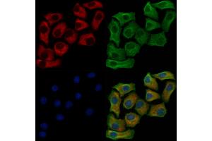 Phospho-GLUT1 (Ser490) Antibody staining Hela cells(heat shock treatment) by IF/ICC.