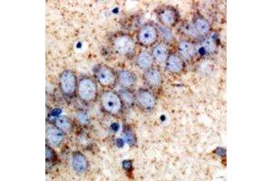Immunohistochemical analysis of SAPK2 staining in rat brain  formalin fixed paraffin embedded tissue section. (MAPK11 antibody)