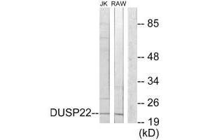 Western blot analysis of extracts from Jurkat cells and RAW264. (DUSP22 antibody)