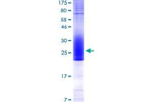 Image no. 1 for CD80 (CD80) (AA 137-230) protein (His-DYKDDDDK-Strep II Tag) (ABIN1348705)