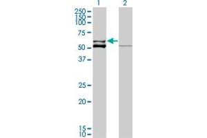 Western Blot analysis of GLUD2 expression in transfected 293T cell line by GLUD2 monoclonal antibody (M01), clone 3C2. (GLUD2 antibody  (AA 1-264))