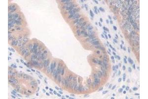 DAB staining on IHC-P; Samples: Mouse Uterus Tissue (CFP antibody  (AA 54-217))