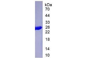 SDS-PAGE of Protein Standard from the Kit (Highly purified E. (Cytokeratin 19 ELISA Kit)