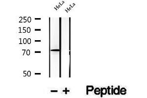 Western blot analysis of extracts of HeLa cells, using TBC1D23 antibody. (TBC1D23 antibody  (Internal Region))