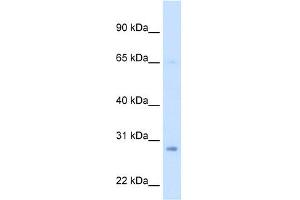 WB Suggested Anti-ECHS1 Antibody Titration:  2. (ECHS1 antibody  (Middle Region))