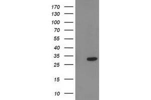 HEK293T cells were transfected with the pCMV6-ENTRY control (Left lane) or pCMV6-ENTRY PNMT (Right lane) cDNA for 48 hrs and lysed. (PNMT antibody)