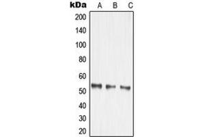 Western blot analysis of MMP14 expression in HEK293T (A), mouse kidney (B), rat brain (C) whole cell lysates. (MMP14 antibody  (Center))