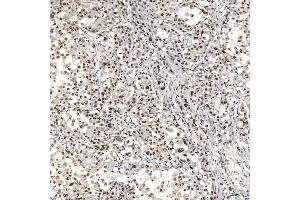IHC analysis of U1A/SNRPA using anti-U1A/SNRPA antibody (ABIN7600891). (SNRPA1 antibody  (AA 25-218))
