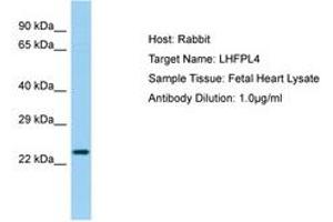 Image no. 1 for anti-Lipoma HMGIC Fusion Partner-Like 4 (LHFPL4) (AA 137-186) antibody (ABIN6750211) (LHFPL4 antibody  (AA 137-186))