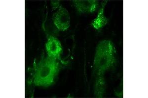 Immunofluorescence (IF) image for anti-Nerve Growth Factor Receptor (NGFR) antibody (ABIN350707)