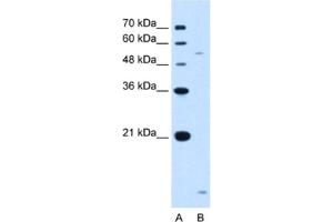 Western Blotting (WB) image for anti-ST3 beta-Galactoside alpha-2,3-Sialyltransferase 5 (ST3GAL5) antibody (ABIN2462977)