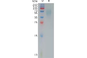 CD200 Receptor 1 (CD200R1) (AA 29-243) protein (His tag)