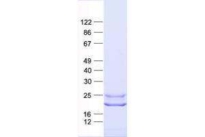 Validation with Western Blot (GUCA1C Protein (His tag))