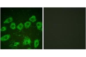 Immunofluorescence (IF) image for anti-Tyrosine Hydroxylase (TH) (AA 10-59) antibody (ABIN2888583) (Tyrosine Hydroxylase antibody  (AA 10-59))