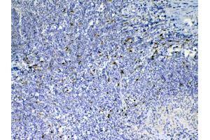 IHC analysis of IL33 using anti-IL33 antibody . (IL-33 antibody  (AA 102-264))