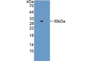 Western blot analysis of recombinant Human LACTb. (LACTB antibody  (AA 313-547))
