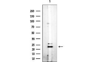 anti-Cyclin-Dependent Kinase 5, Regulatory Subunit 1 (p35) (CDK5R1) antibody