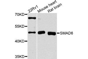 Western blot analysis of extracts of various cell lines, using SMAD6 antibody (ABIN5970214) at 1/1000 dilution. (SMAD6 antibody)