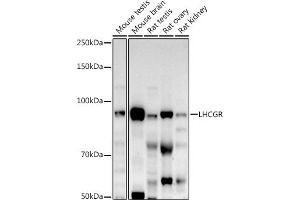 Western blot analysis of extracts of various cell lines, using LHCGR antibody (ABIN6128180, ABIN6143185, ABIN6143186 and ABIN6221866) at 1:500 dilution. (LHCGR antibody  (AA 200-360))