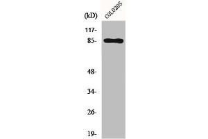 Western Blot analysis of COLO205 cells using Fyb Polyclonal Antibody (FYB1 antibody  (C-Term))