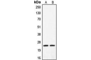Western blot analysis of Claudin 2 expression in HeLa (A), A431 (B) whole cell lysates.