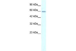 WB Suggested Anti-ZNF543 Antibody Titration:  0. (ZNF543 antibody  (Middle Region))